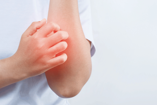 image of hand scratching near elbow