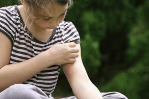Best Antihistamines for Bug and Insect Bites