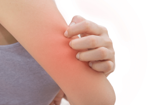 itchy skin antihsitamine